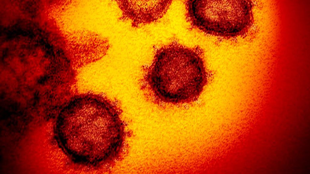 Coronavirus y su corona (las protuberancias en su exterior) vistos al microscopio