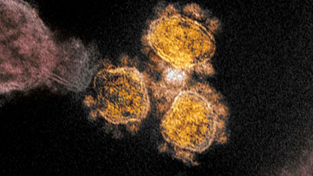 Coronavirus visto al microscopio