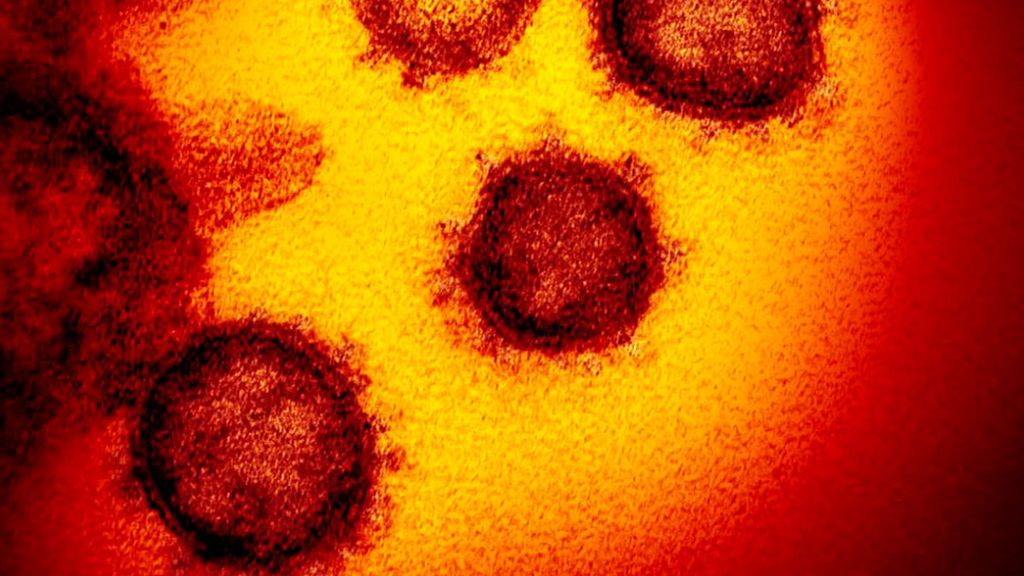 Israel contiene la llegada del coronavirus mientras las infecciones crecen en Oriente Próximo Israel contiene la llegada del coronavirus mientras las infecciones crecen en Oriente Próximo