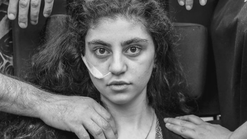 Ewa, la imagen del síndrome de resignación en niños refugiados, finalista del World Press Photo