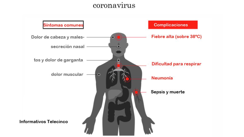 coronavirus-sintomas