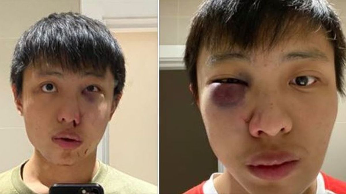 Atacan a un joven singapurense en Londres: 'No quiero tu coronavirus en mi país'