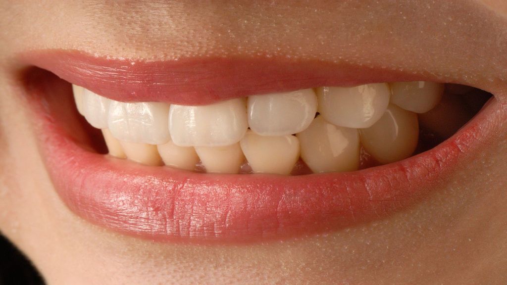 Implantes de porcelana o zirconio: cómo saber cuál elegir