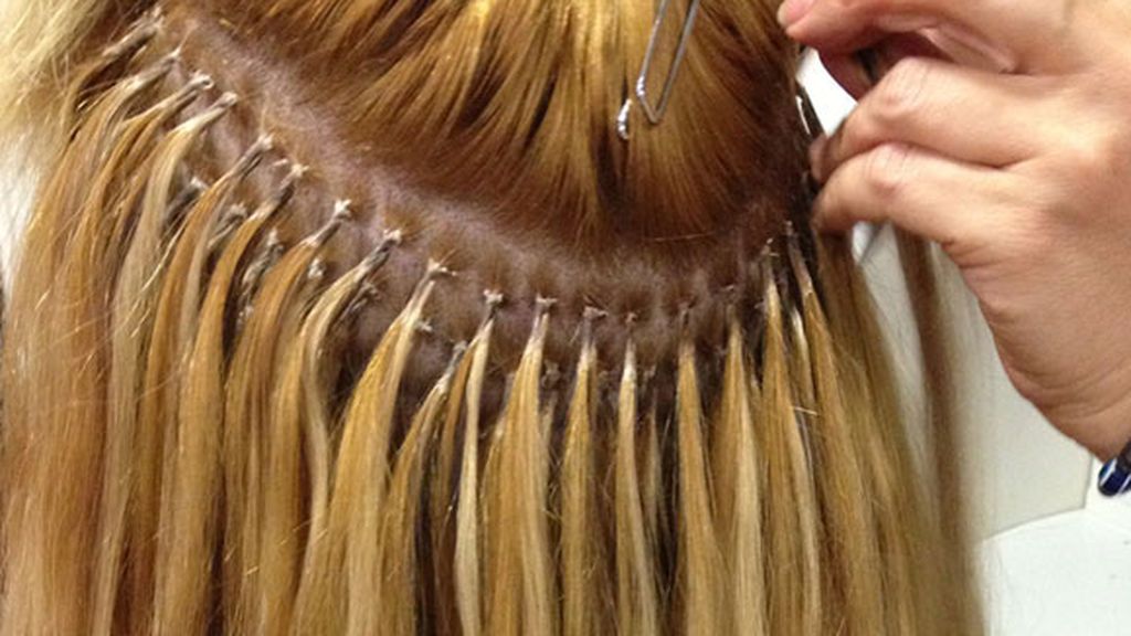 Las extensiones fijas.