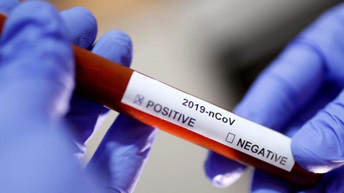 Científicos islandeses afirman haber encontrado cuarenta mutaciones del coronavirus