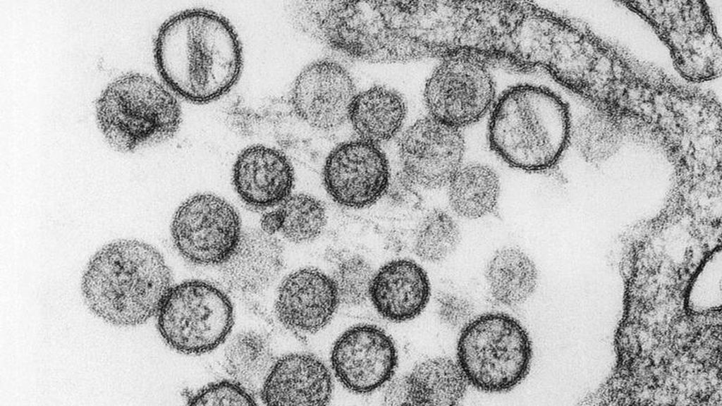 El hantavirus, a vista de microscopio