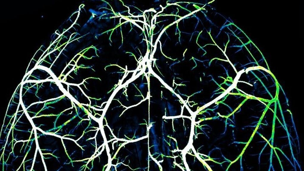EuropaPress_2658131_arterias_cerebro
