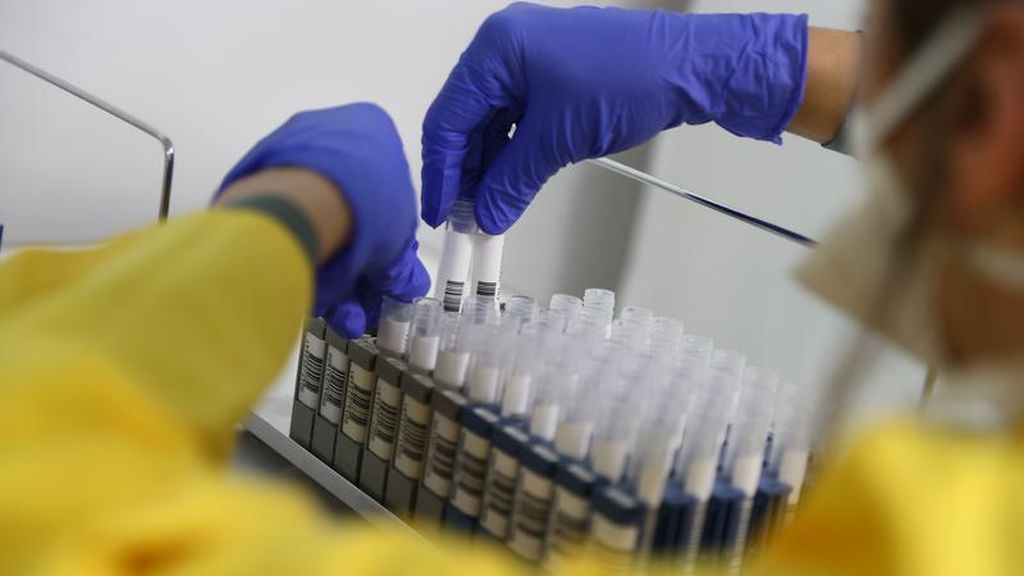 Test rápido para el coronavirus desarrollado por Alemania