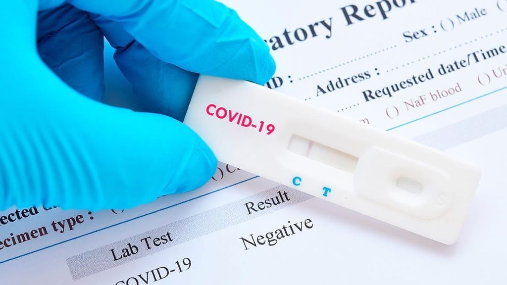 Sanidad usará los test rápidos "de forma complementaria", por su baja fiabilidad Sanidad usará los test rápidos "de forma complementaria", por su baja fiabilidad