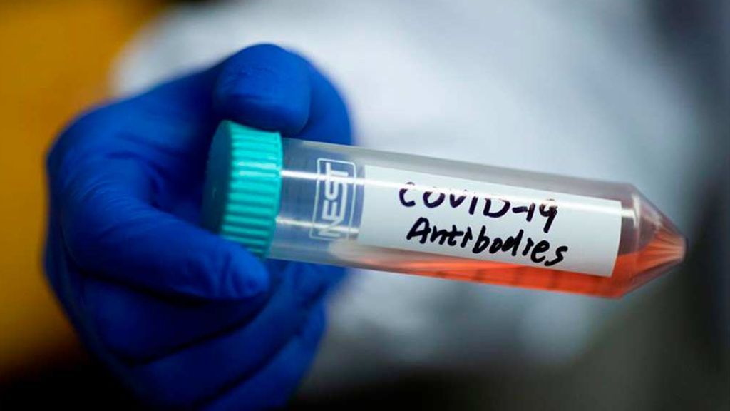 Avance en las vacunas contra el coronavirus: Australia comienza a probarla en animales Avance en las vacunas contra el coronavirus: Australia comienza a probarla en animales