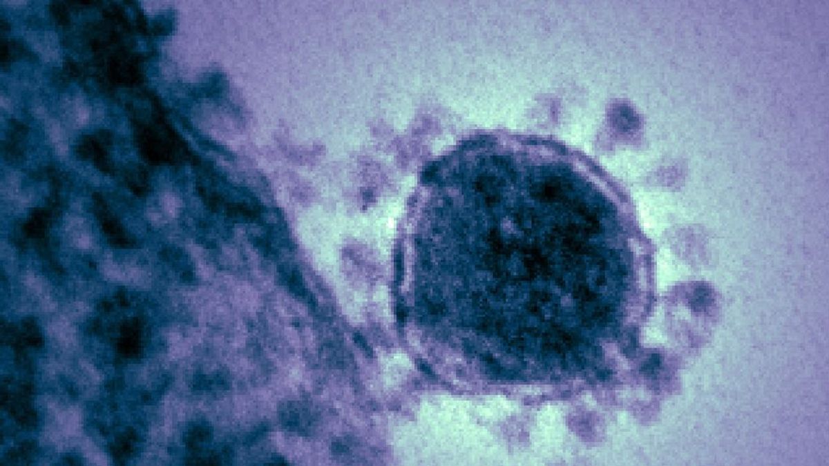 El mayor experto infectólogo de EEUU: "El coronavirus regresará en otoño"