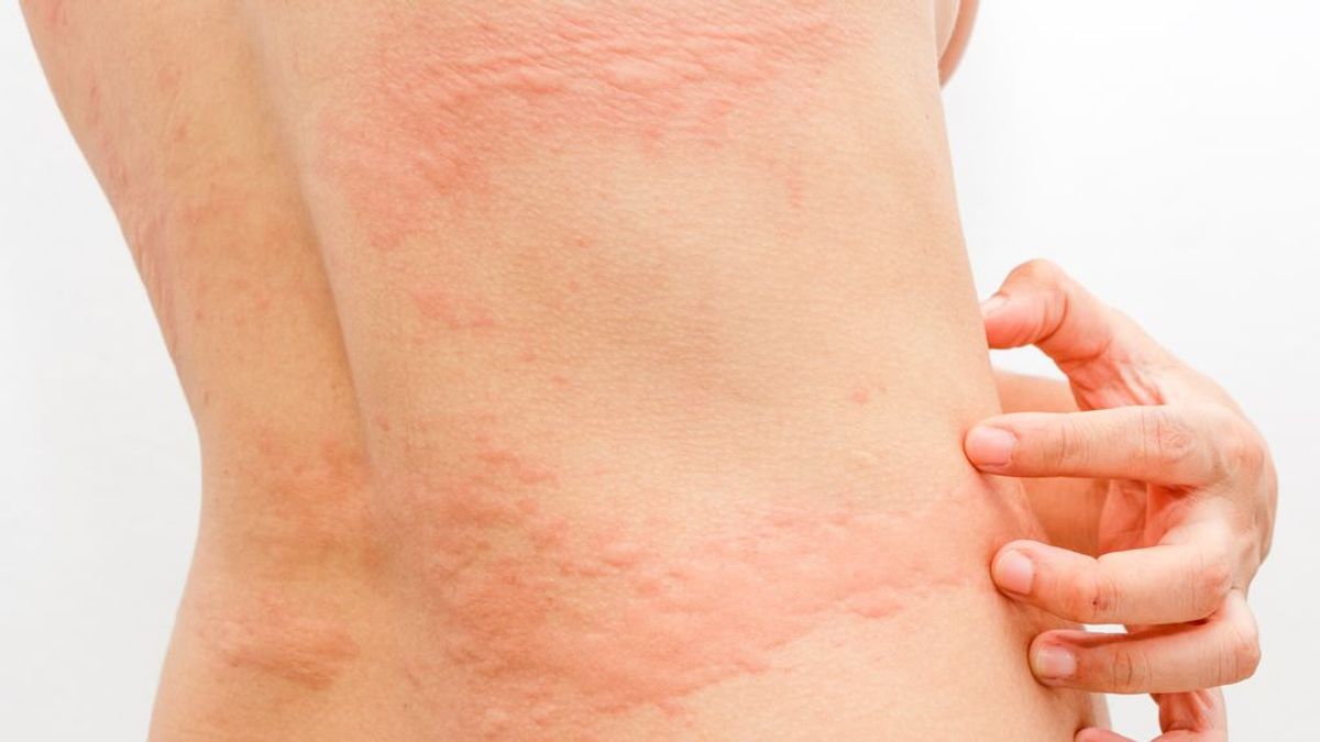 Dermatólogos españoles lanzan un estudio para conocer el impacto del coronavirus en la piel Dermatólogos españoles lanzan un estudio para conocer el impacto del coronavirus en la piel