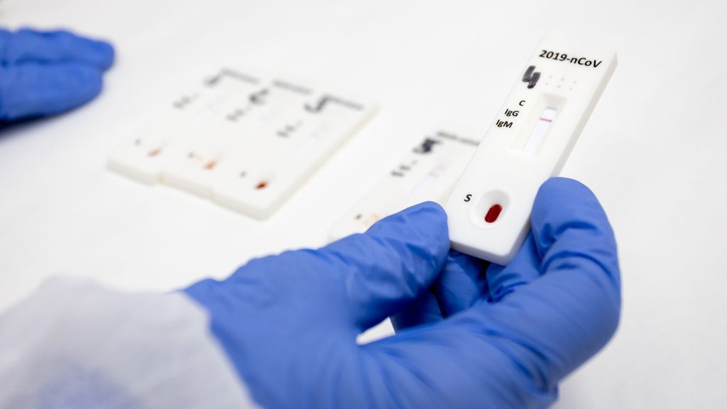 La Junta de Andalucía reparte 90.000 test rápidos entre las residencias con ancianos fallecidos por coronavirus La Junta de Andalucía reparte 90.000 test rápidos entre las residencias con ancianos fallecidos por coronavirus