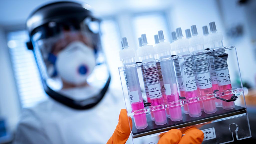 España participará en uno de los mayores ensayos clínicos de Europa para prevenir el coronavirus en sanitarios España participará en uno de los mayores ensayos clínicos de Europa para prevenir el coronavirus en sanitarios