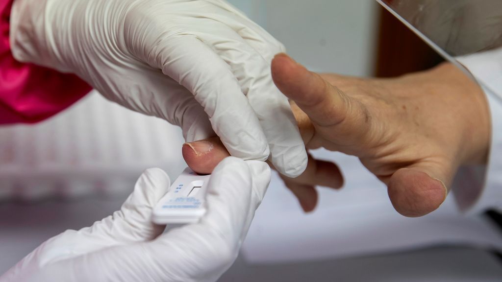 Sanidad justifica la intervención de los laboratorios privados para "evitar abusos" con los test de pago Sanidad justifica la intervención de los laboratorios privados para "evitar abusos" con los test de pago