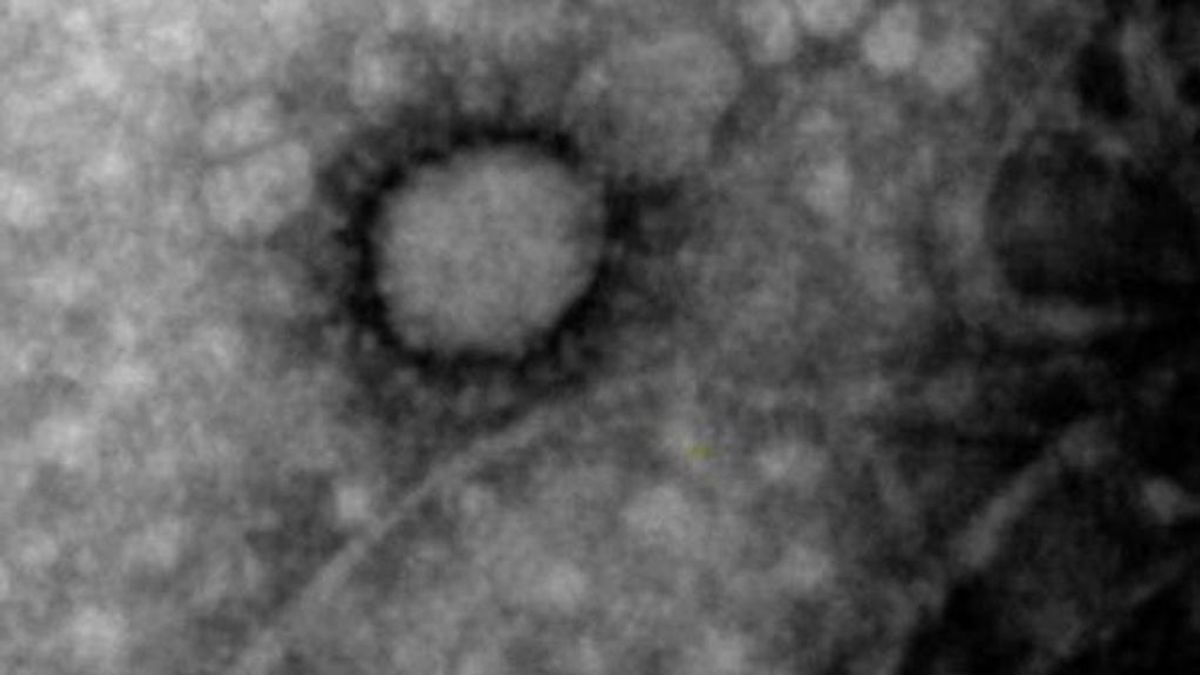 El coronavirus como nunca lo habías visto: fotografías del asesino a nivel microscópico