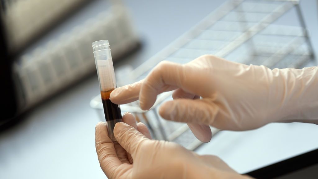 Un bote con sangre tras ser analizada