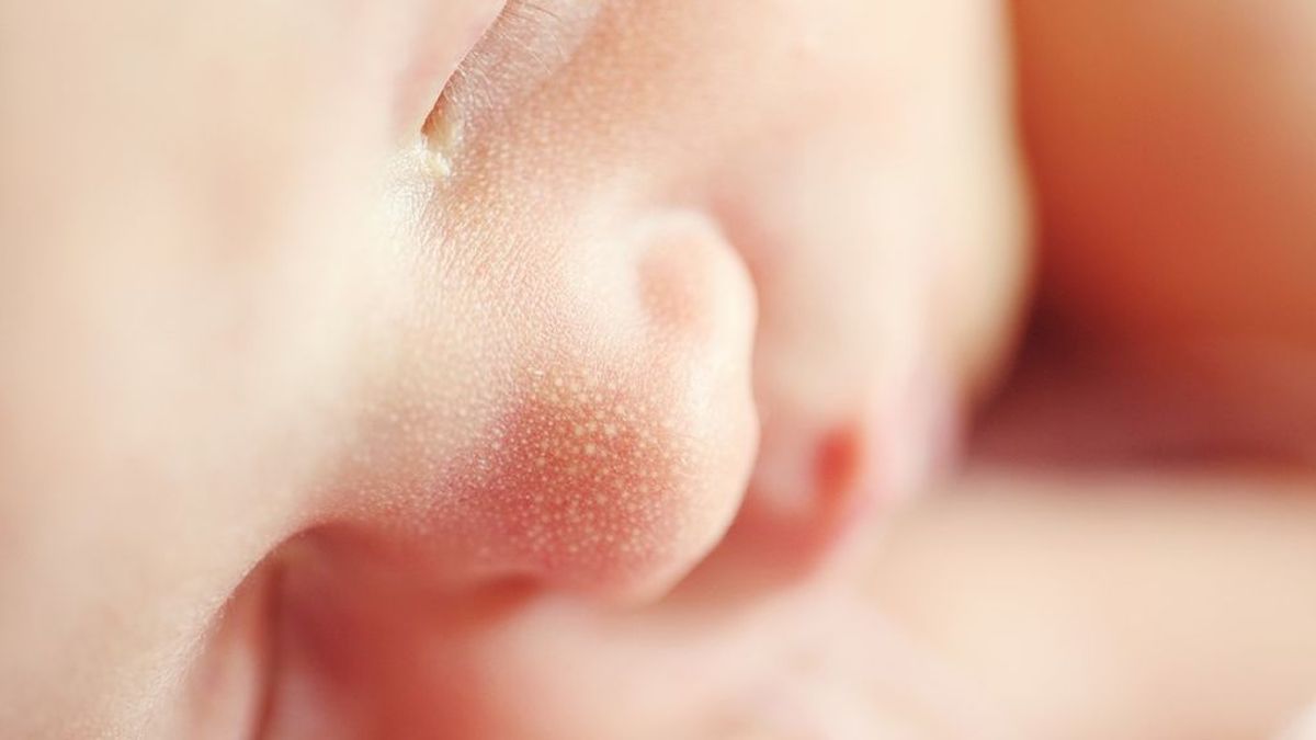 ¿Qué son y por qué salen las engordaderas en los bebés?