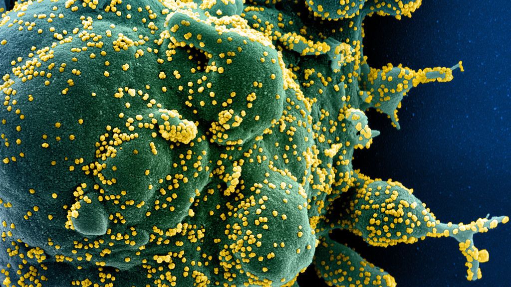 La UE decidiría "en días" si aprueba el uso del antiviral remdesivir para contra el coronavirus La UE decidiría "en días" si aprueba el uso del antiviral remdesivir para contra el coronavirus