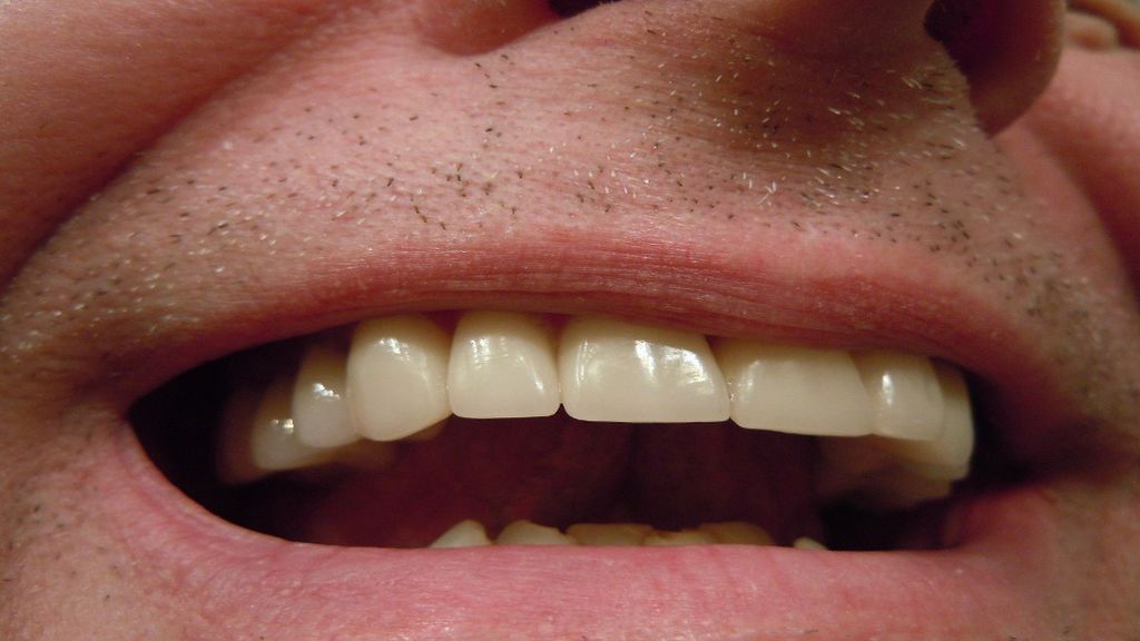 Consejos para mantener limpia tu dentadura postiza - Uppers