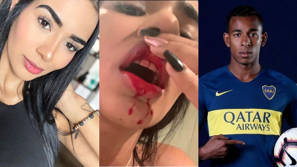 Una mujer denuncia que perdió al bebé que esperaba por la paliza del futbolista Sebastian Villa: "Me pegó hasta sangrar" Una mujer denuncia que perdió al bebé que esperaba por la paliza del futbolista Sebastian Villa: "Me pegó hasta sangrar"