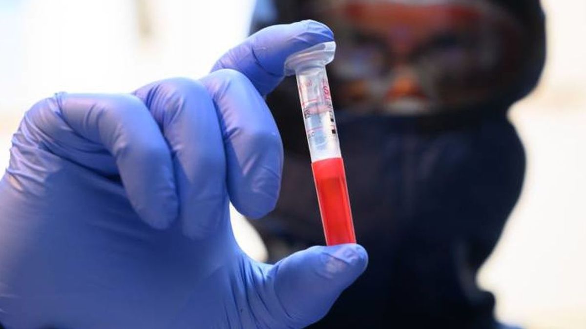 Francia descubre ahora que ya tenían un paciente con coronavirus a finales de diciembre de 2019