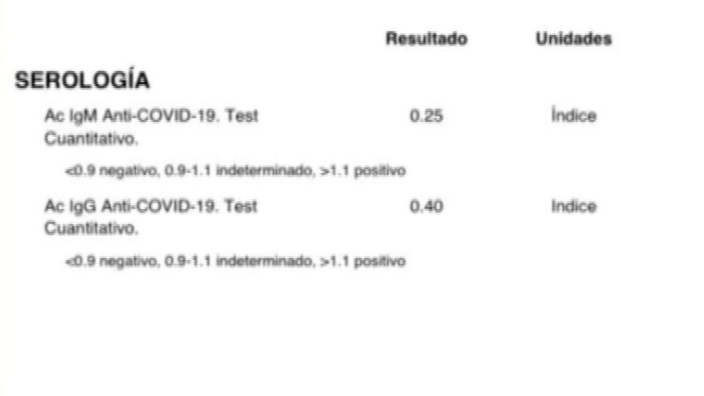 Cómo interpretar los resultados de los test de coronavirus - NIUS