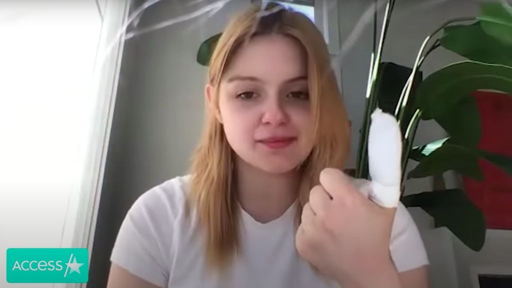 Ariel Winter muestra las secuelas de su incidente