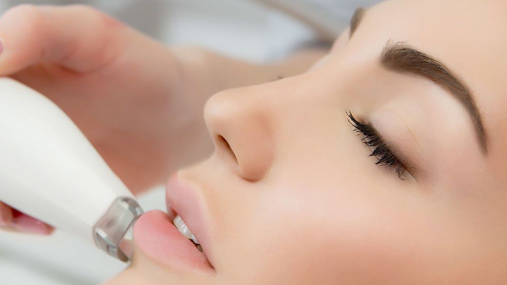 ¿En qué consiste la radiofrecuencia facial?