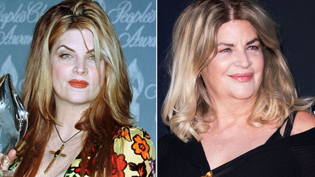 El antes y el después de Kirstie Alley (1998-2020)