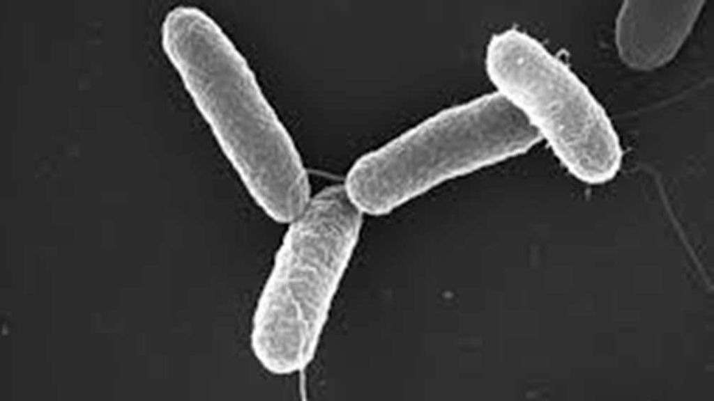 Salmonella-Typhimurium