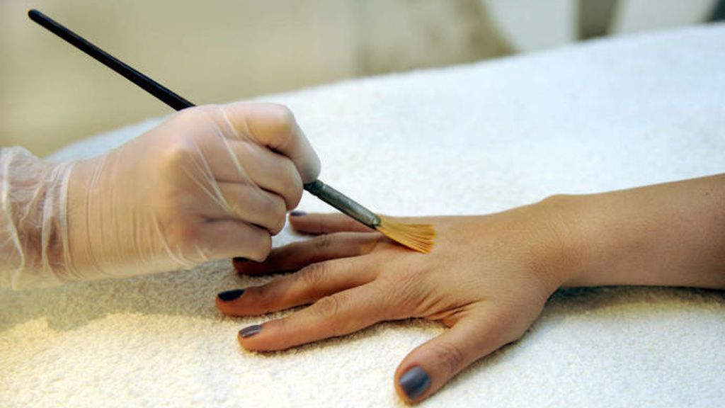 También, el peeling químico servirá para eliminar las manchas.