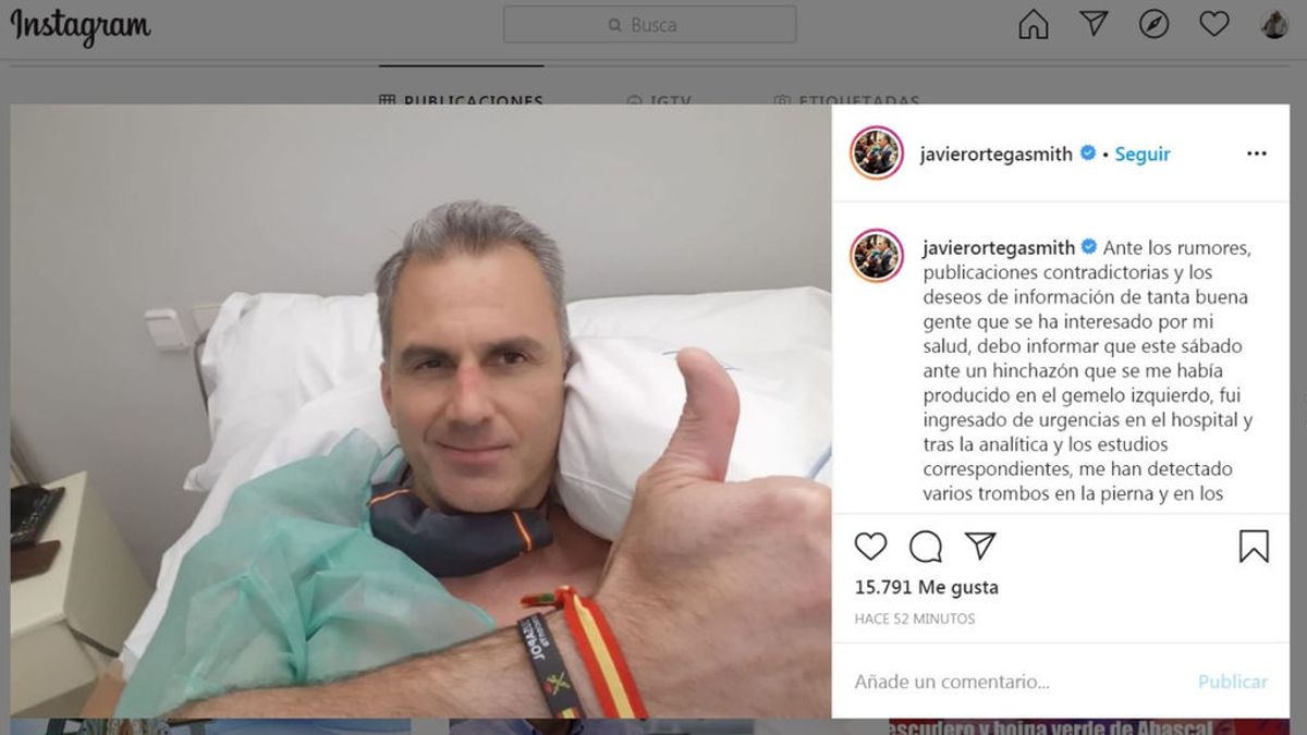 Ortega Smith ingresado con trombos en los pulmones y una pierna causados por el coronavirus Ortega Smith ingresado con trombos en los pulmones y una pierna causados por el coronavirus