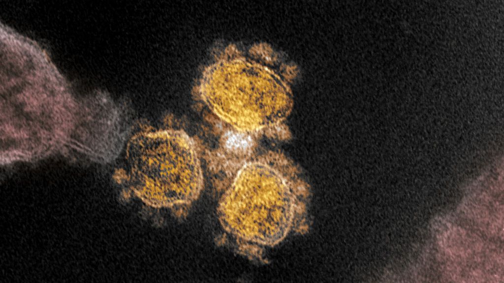 Trombos, ictus, diarrea, pérdida de olfato, niños con dolor de tripa: las complicaciones tardías del coronavirus Trombos, ictus, diarrea, pérdida de olfato, niños con dolor de tripa: las complicaciones tardías del coronavirus