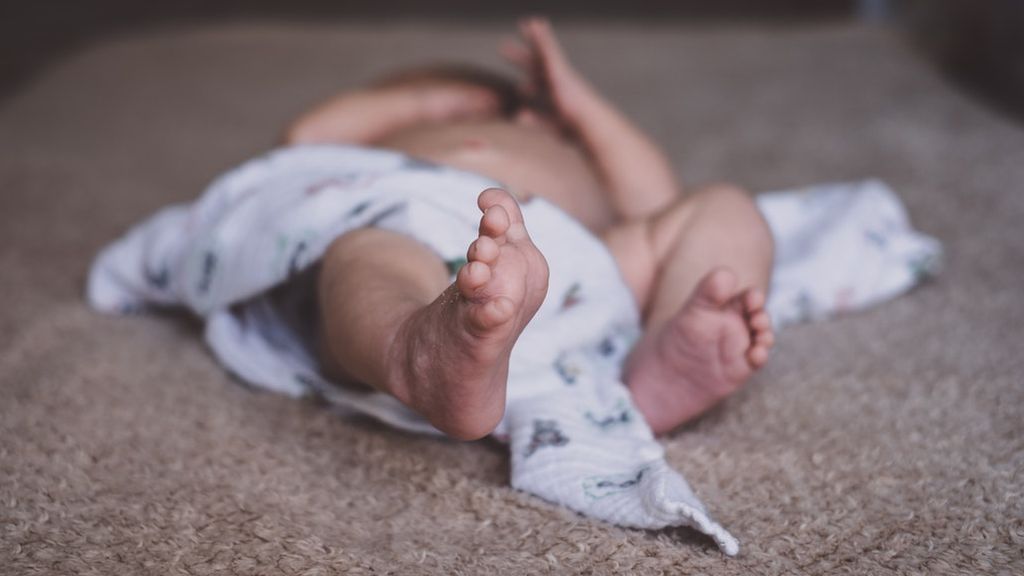 fimosis-bebe-1