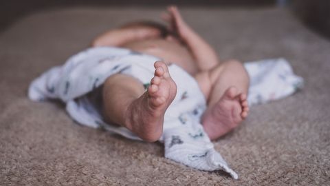 Como Saber Si Mi Bebe Tiene Fimosis Divinity