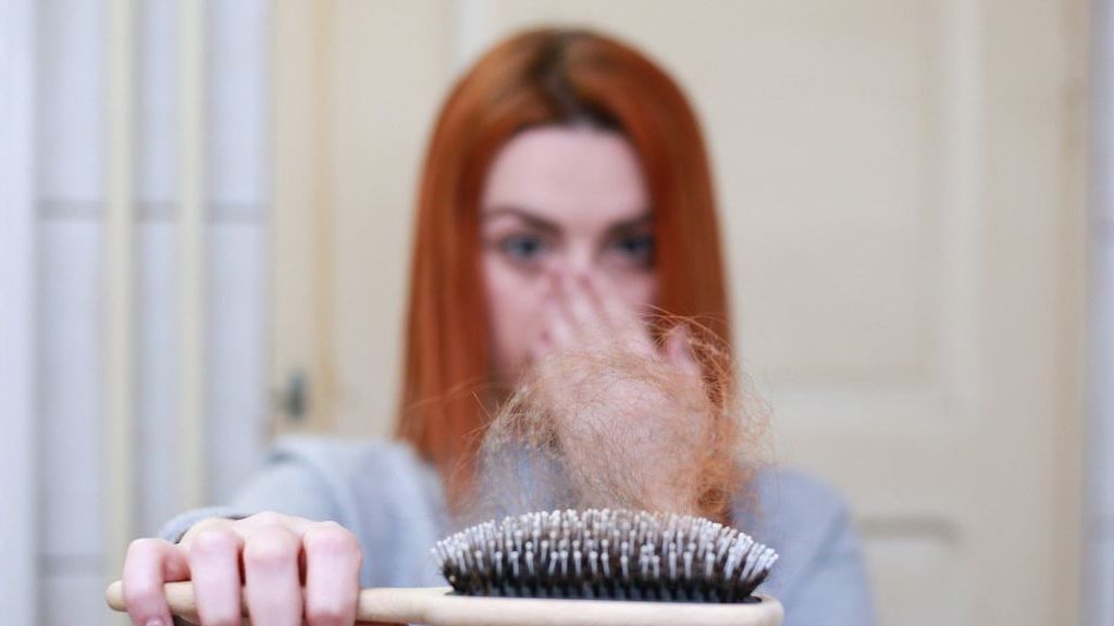 Cuando la caída del pelo es una cuestión de efluvio temporal Cuando la caída del pelo es una cuestión de efluvio temporal