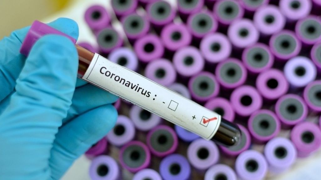 El Gregorio Marañón estudia si los pacientes con VIH tienen "especial protección" frente al Covid-19 El Gregorio Marañón estudia si los pacientes con VIH tienen "especial protección" frente al Covid-19