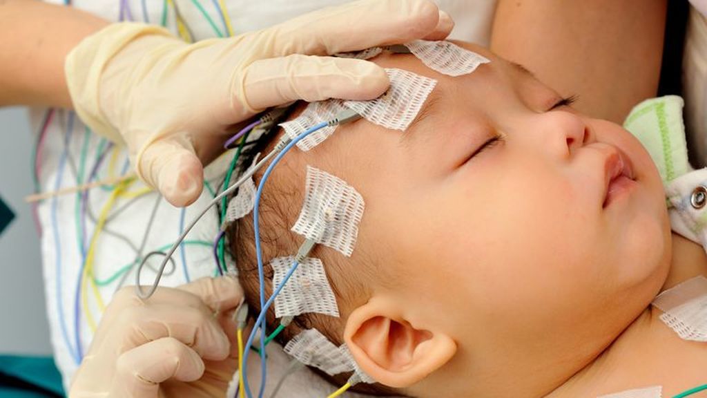Al bebé se le realizará un ultrasonido craneal, tomografía, resonancia magnética, análisis de sangre, análisis de orina y una punción lumbar.