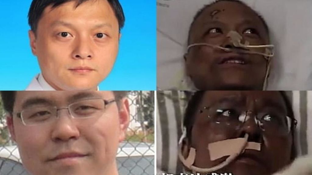 Muere uno de los médicos chinos que se volvió negro por el tratamiento del COVID tras cuatro meses enfermo Muere uno de los médicos chinos que se volvió negro por el tratamiento del COVID tras cuatro meses enfermo
