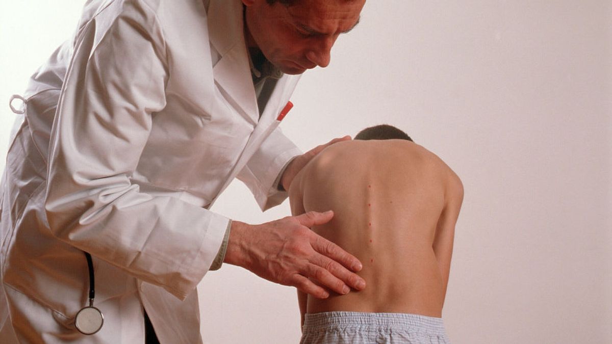 Escoliosis: la importancia de cuidar la espalda desde pequeños