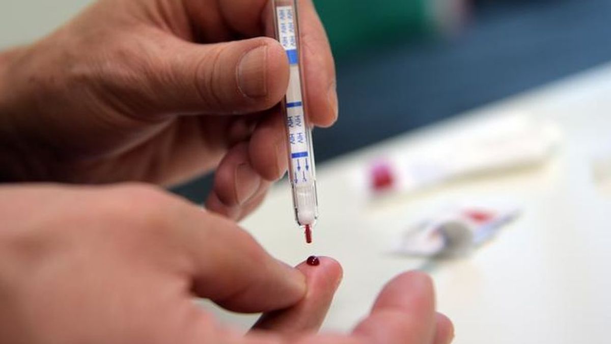 Sanidad permite hacer test rápidos de VIH en el domicilio, que se podrán adquirir en las farmacias