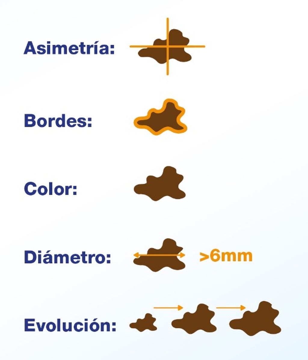12_5_20_DIA_EUROPEO_PREVENCION_CANCER_PIEL
