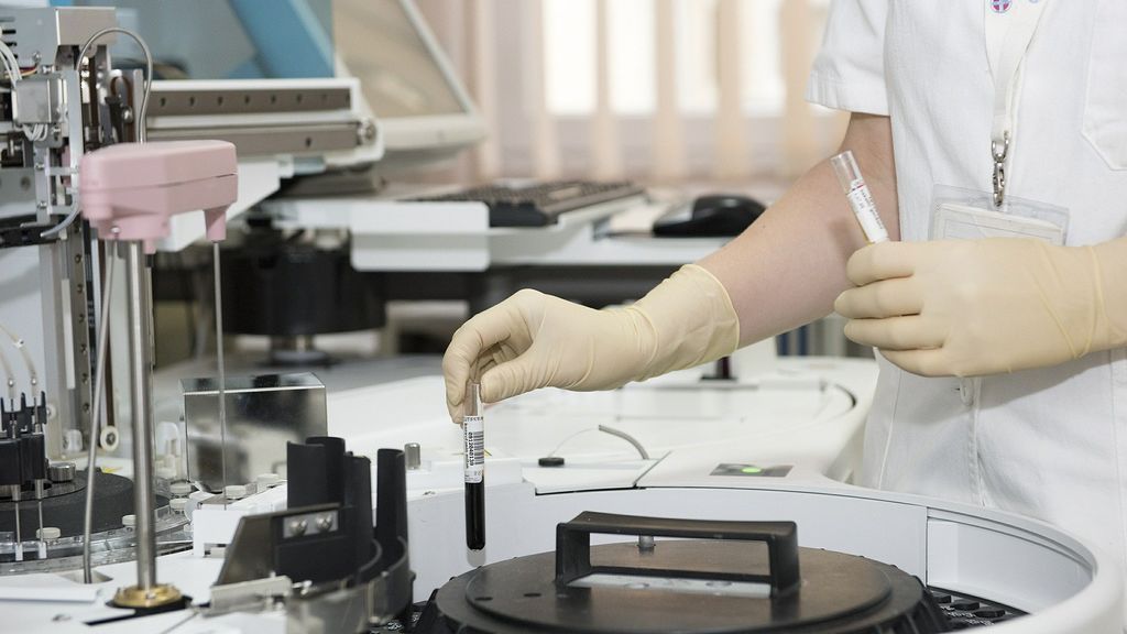 Un estudio demuestra que los pacientes con COVID pueden desarrollar diabetes