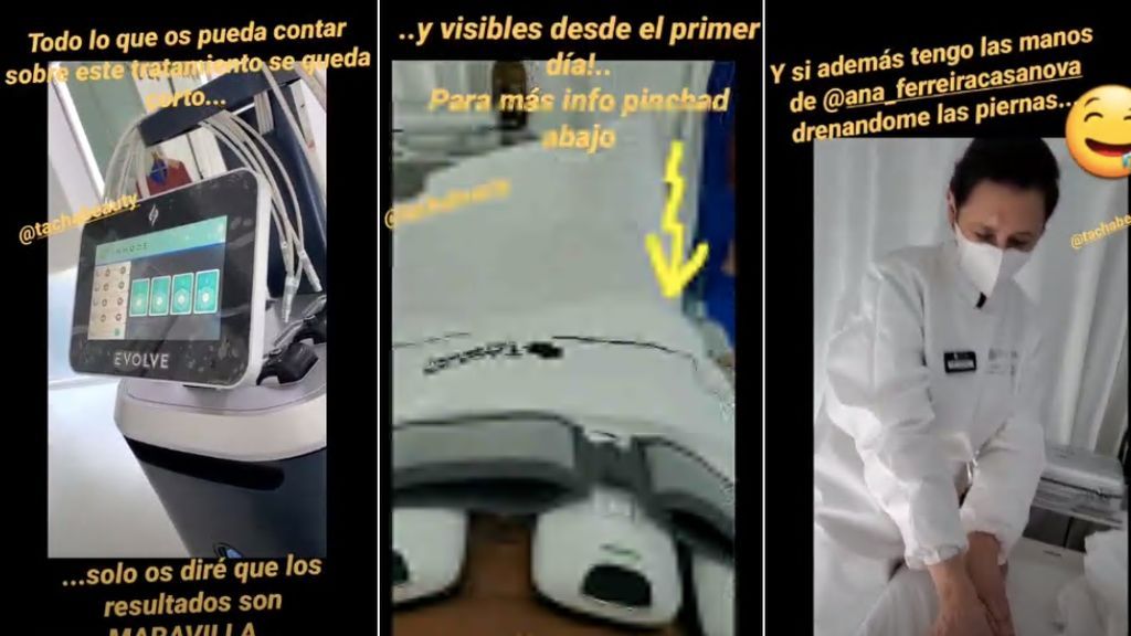 El tratamiento de Paula