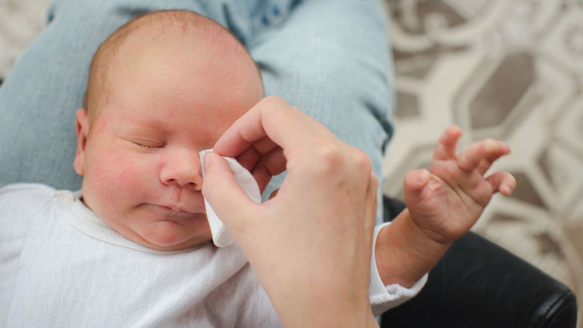 Conjuntivitis en bebés, todo lo que necesitas saber sobre el cuidado del ojo.