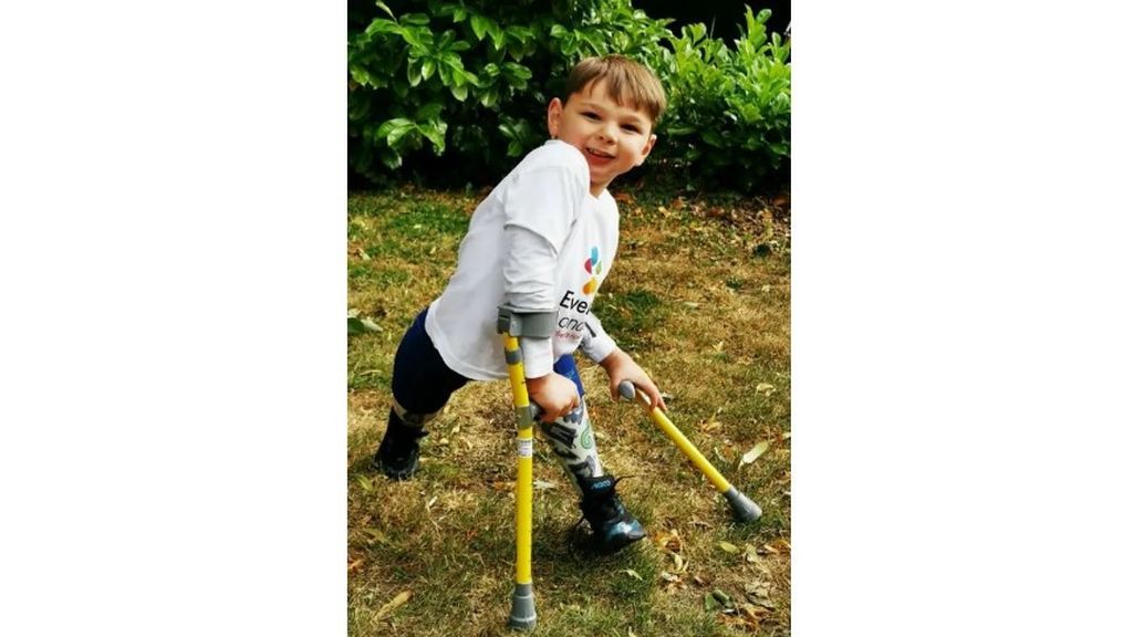 Tony, el niño de cinco años que con dos prótesis camina 10 kilómetros para recaudar fondos para el hospital que lo salvó