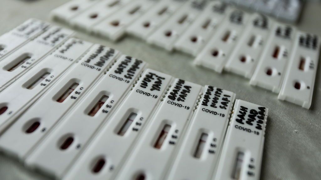 Siete nuevos casos de coronavirus en Murcia obligan a cerrar una empresa y elevan los contagios a 32 Siete nuevos casos de coronavirus en Murcia obligan a cerrar una empresa y elevan los contagios a 32