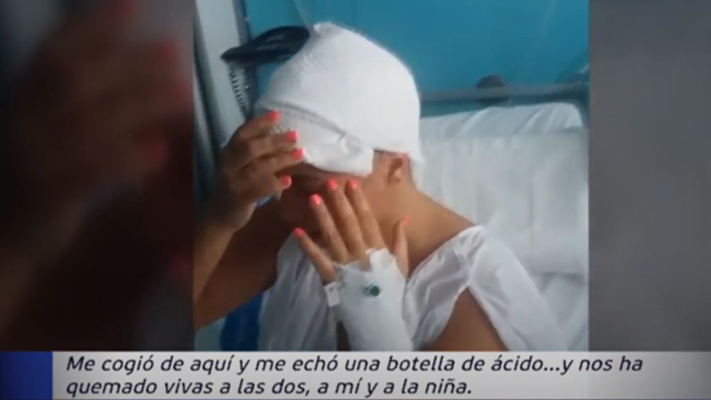 El terrible testimonio de Ana Mari tras ser atacada junto a su hija con un bote de ácido