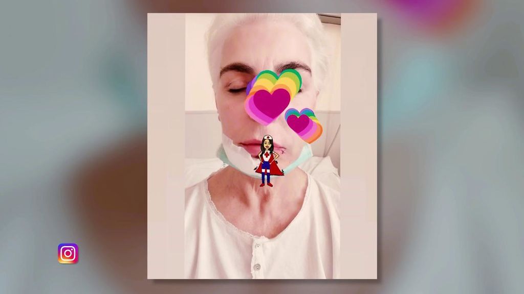 Antonia Dell’Atte sufre un accidente en la playa: “Me tienen que reconstruir la mandíbula”